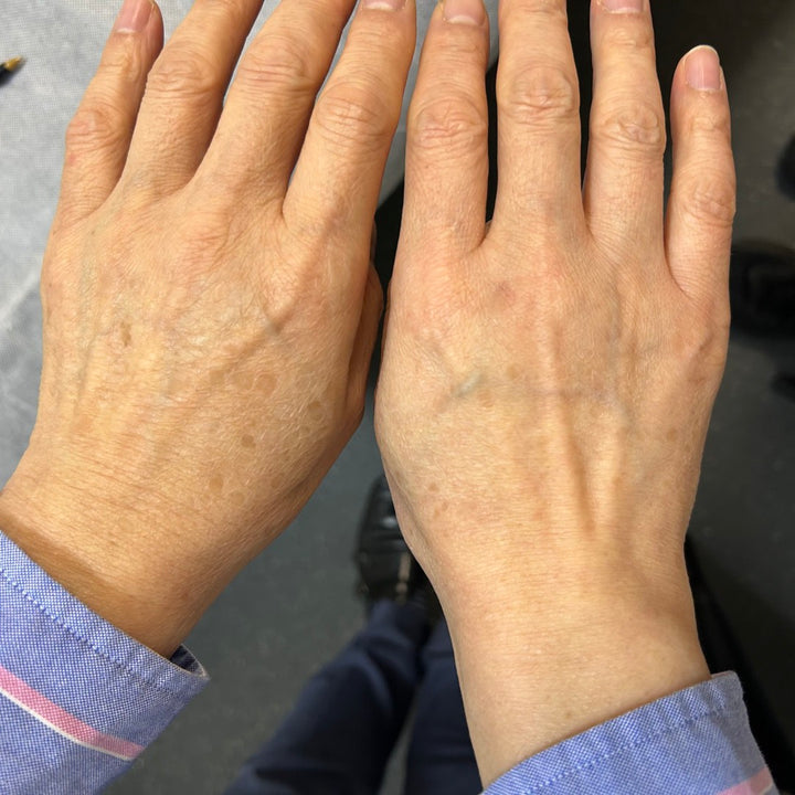 Real results on real skin